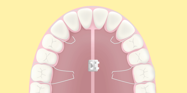 矯正歯科画像1